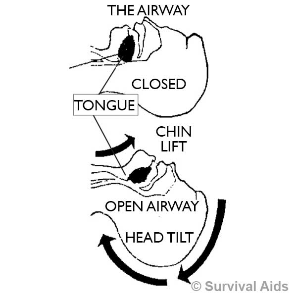 Medical And First Aid